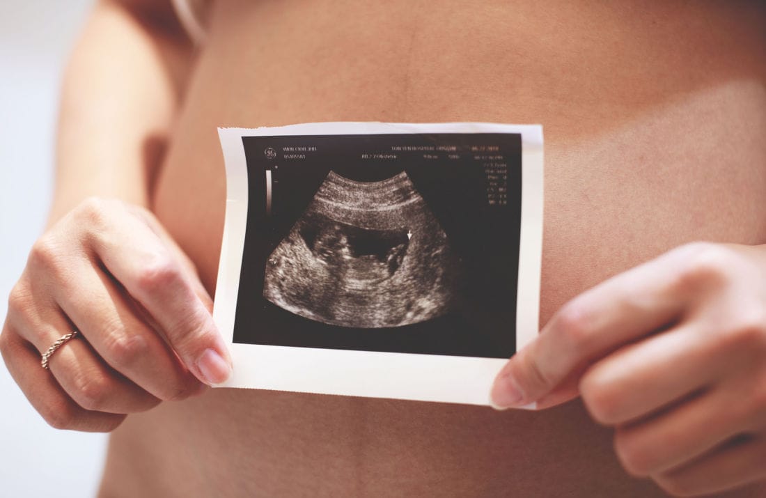 Avortement : les retombées de la décision de la Cour suprême américaine