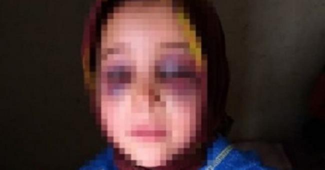 L’enseignant qui a maltraité une élève de 8 ans écope de 10 mois de prison 2 Affaire Meriem