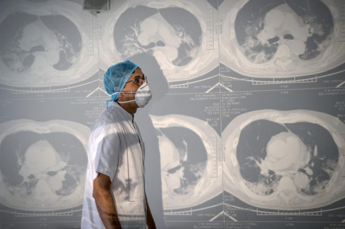 Covid-19 : bilan, masques et confinement... en attendant le pic de l'épidémie 2 Covid-19 : bilan, masques et confinement... on vous dit tout