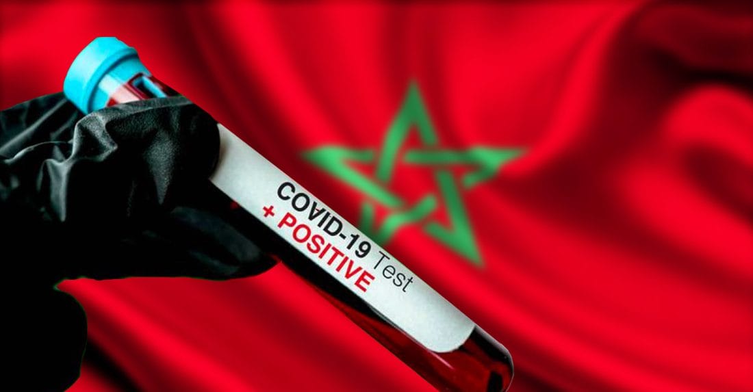 Covid-19 : 1240 guérisons, contre 1191 contaminations ce lundi 31 août