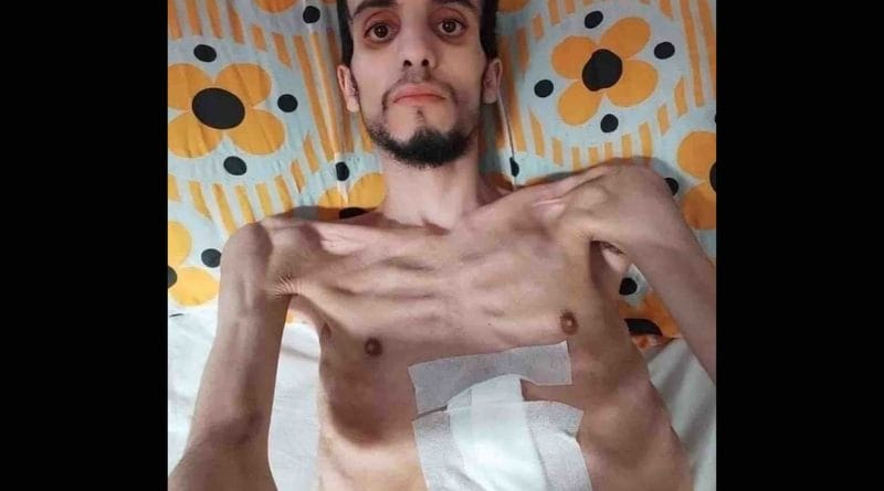 L’appel à l’aide émouvant d’un jeune marocain atteint de cancer 2 Nabil Choubed
