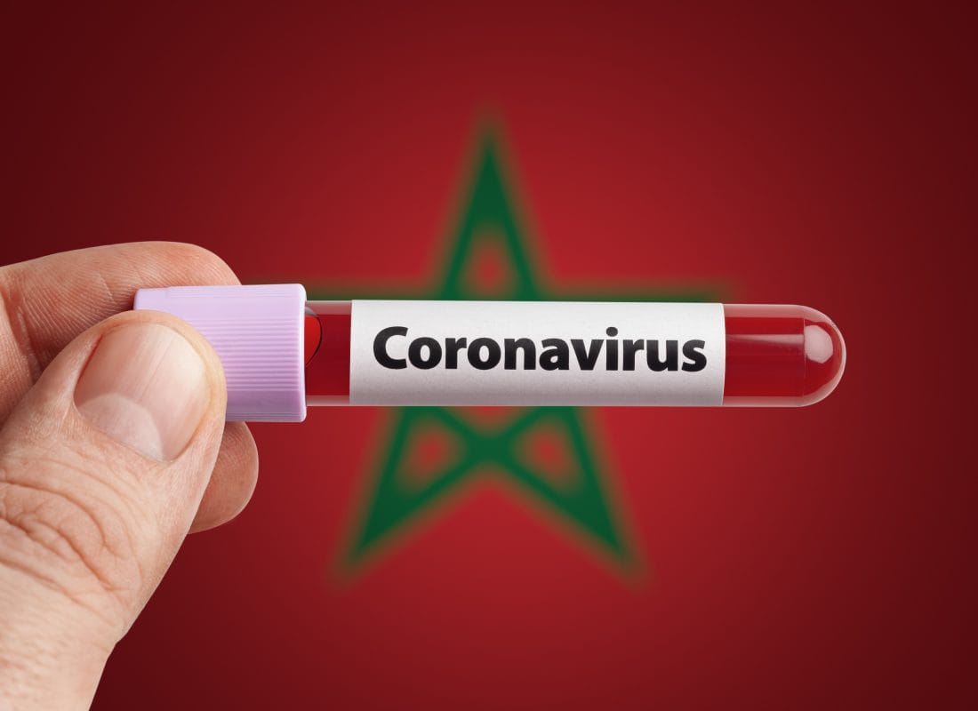 Covid-19 : la situation épidémiologique est en constante amélioration