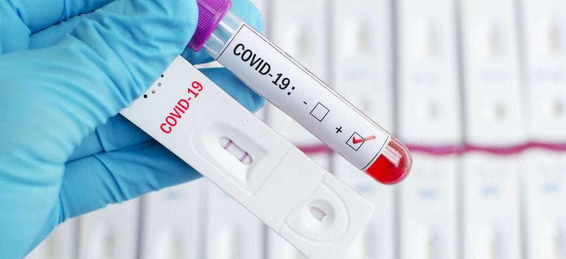 Covid-19 : faut-il craindre le même scénario qu'en 2020 ? 2 Covid-19 : faut-il craindre le même scénario qu'en 2020 ?