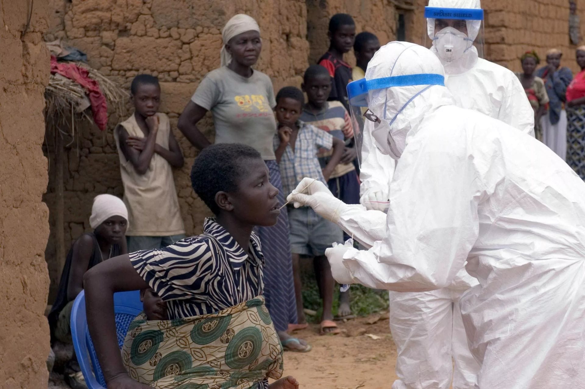 Virus de Marburg : ce qu’il faut savoir