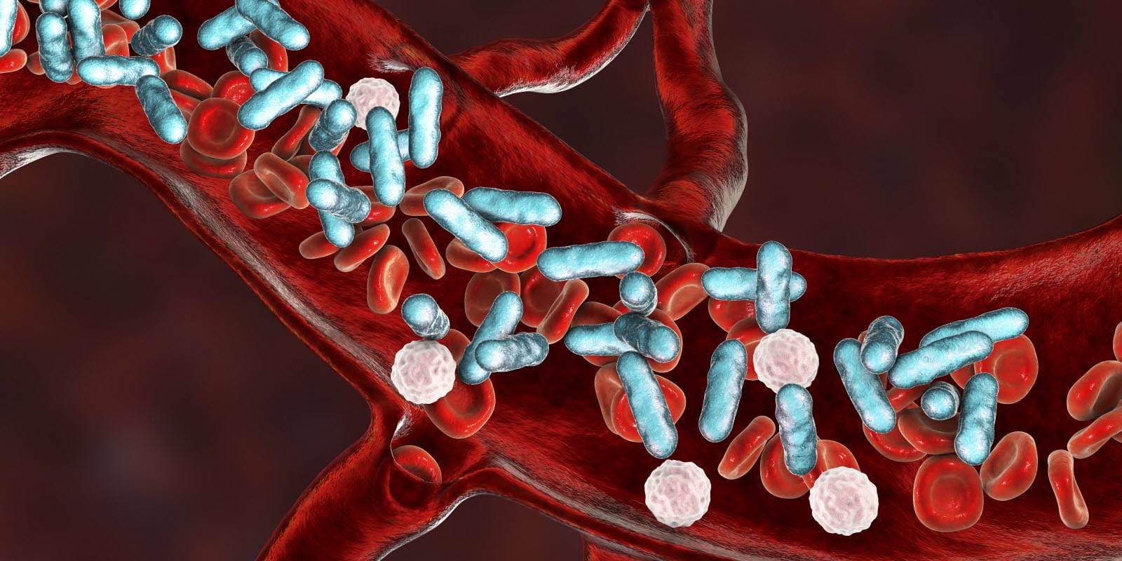 Sepsis : une maladie mortelle, mais peu connue !