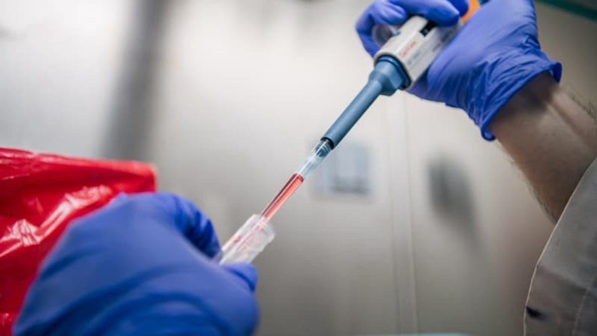 L’OMS recense les agents pathogènes susceptibles de causer des pandémies