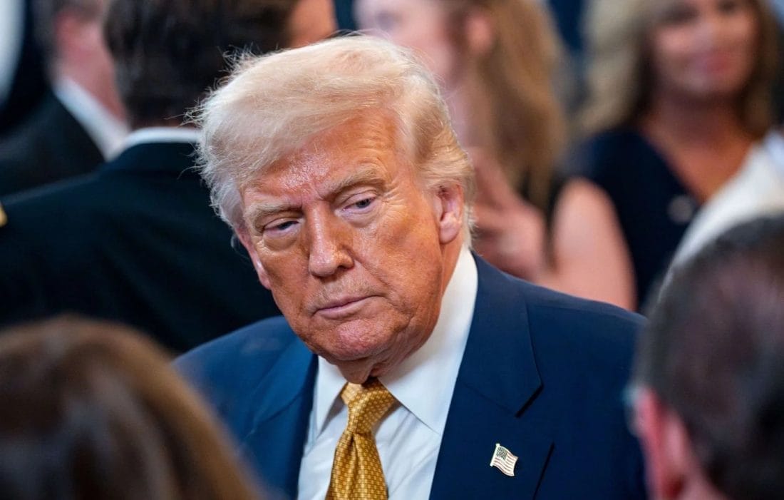 Donald Trump souffre d’une insuffisance veineuse